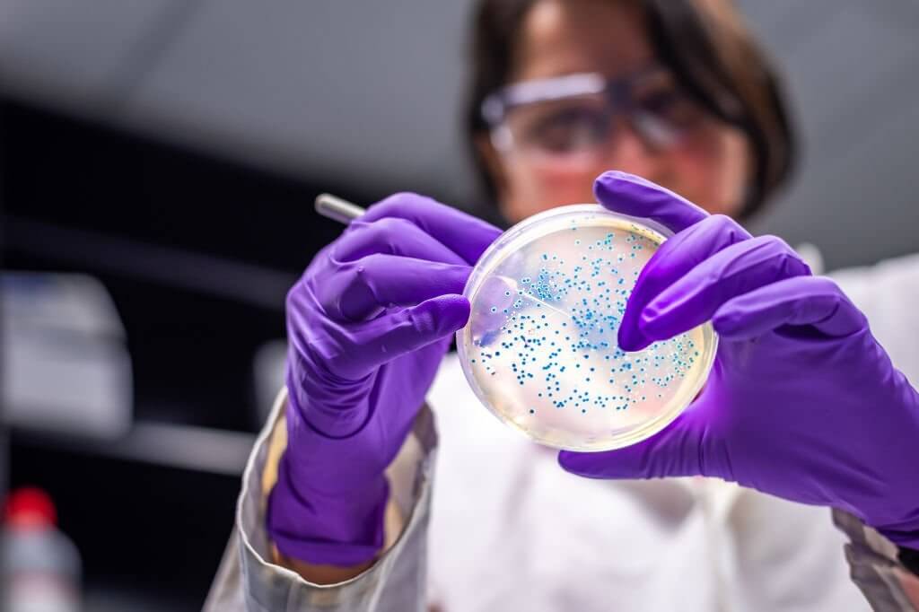 Woman researcher performing examination of bacterial culture plate