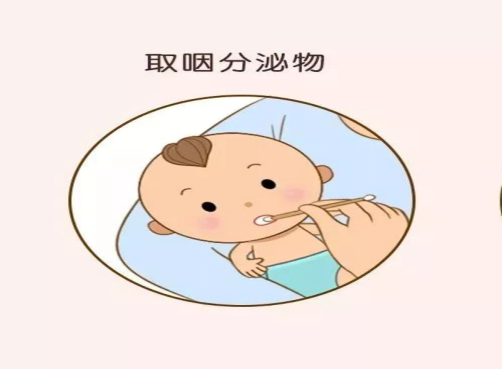 小孩口咽拭子采样.png